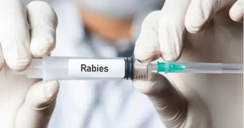 ৰেবিজ ভেকচিনৰ আৱিষ্কাৰৰ কাহিনী- Invention of Rabies vaccine