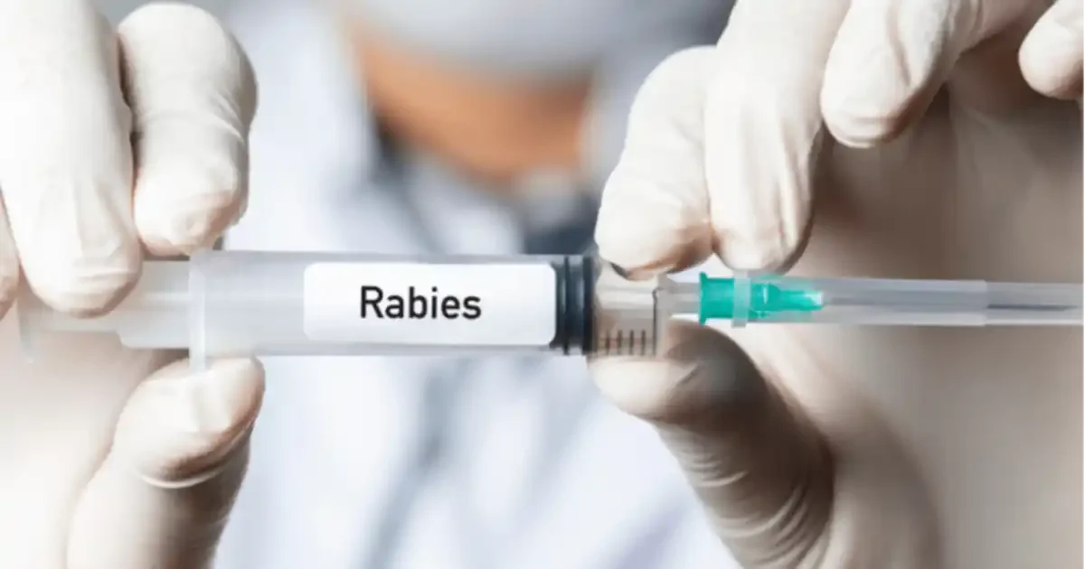 Rabies vaccine, ৰেবিজ